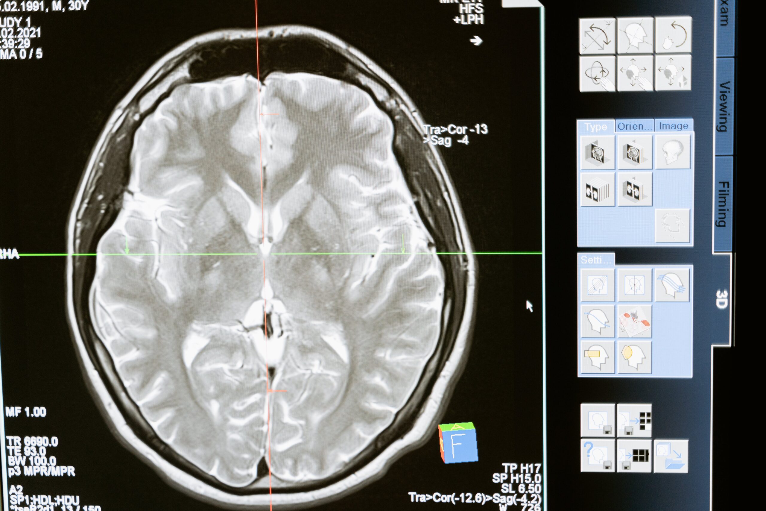 Technology computer head health
